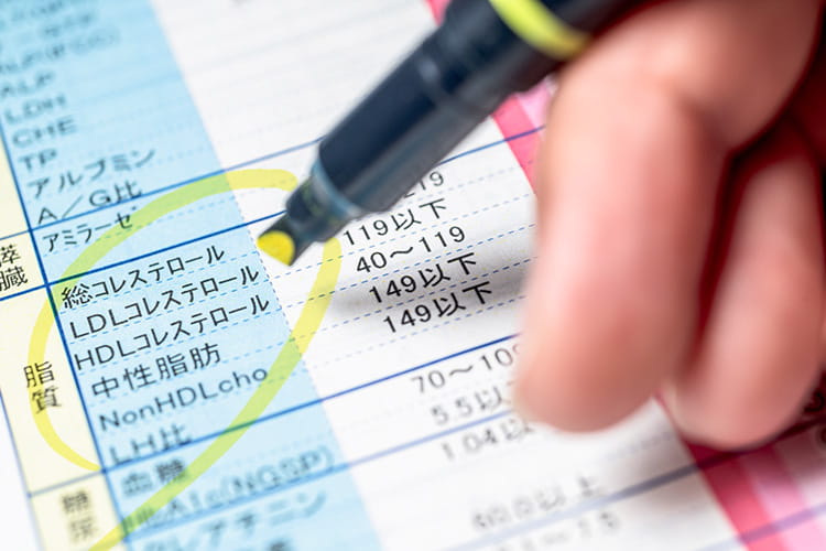 脂質異常症イメージ画像